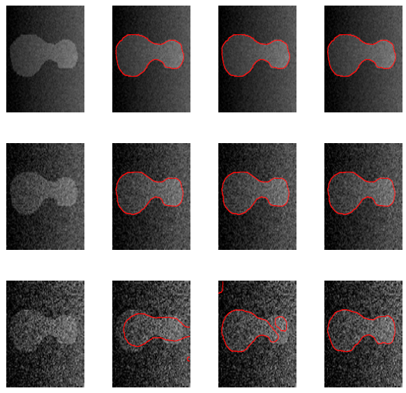Enhanced Global Image Segmentation: Addressing Pixel Inhomogeneity