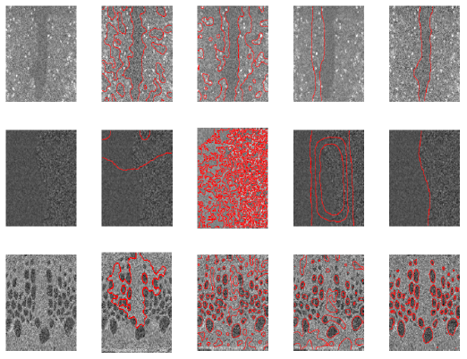 Enhanced Global Image Segmentation: Addressing Pixel Inhomogeneity